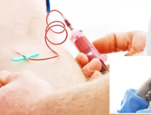 Bakan Işıkhan’dan nadir hastalıkların tedavisine destek açıklaması: Hemofili A hastalarına evde tedavi kolaylığı