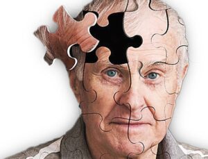 İğne, Hap ve Umut: Alzheimer’a karşı son cephe