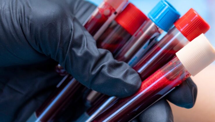 Tek tüp kanla Alzheimer teşhisi: Erken tanı artık mümkün