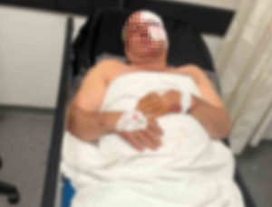 Motosiklet kazasında yaralandı, kardeşinin çarptığını iddia etti