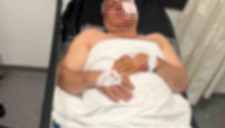 Motosiklet kazasında yaralandı, kardeşinin çarptığını iddia etti