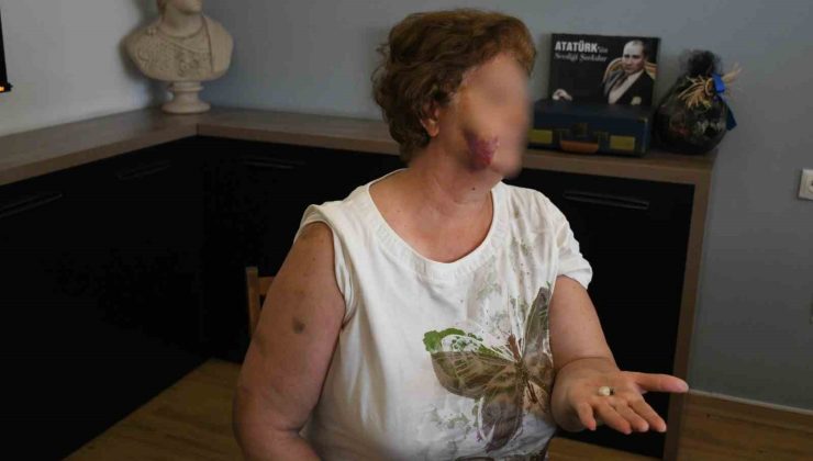 Kuşadası’nda ev kavgası kanlı bitti: Anne ve iki çocuğu bıçaklandı